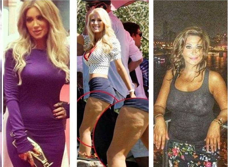 نجمات عربيات وعالميات يعانين من السيلوليت والكرش..شاهدوا صور تكشف الحقيقة الصادمة!